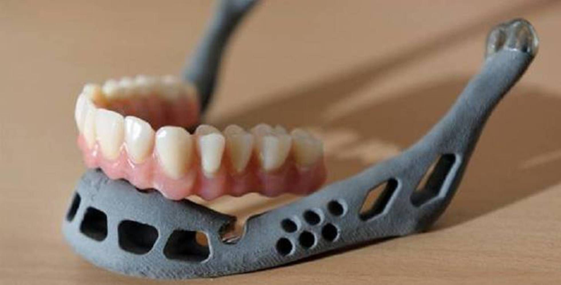 El primer trasplante de mandíbula construido con una impresora 3D es implantado en un niño en China